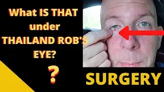 I HAVE TO HAVE SURGERY V534