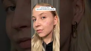 Don’t forget that social media is full of these filters! #realskin