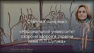 Стелла Кушніренко