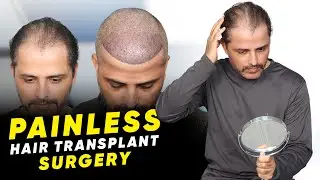 Hair Transplant in Jaipur | Best Results & Cost of Hair Transplant in Jaipur