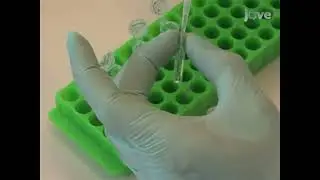 Basophil Activation Test for assessing IgE-mediated responses in drug hypersensitivity