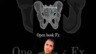 Pelvic ring fractures - 