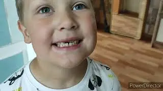 У нас новые зубы 😁 у нас ТАНЦЫ