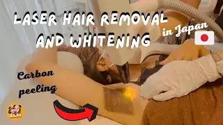 I TRIED LASER HAIR REMOVAL (IPL) and UNDERARM WHITENING (Carbon peeling) in Japan| 🇵🇭🇯🇵| maijettv