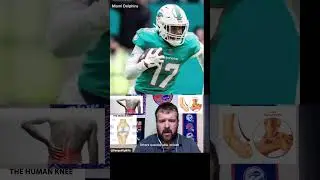 WHO'S IN & WHO'S OUT Miami Dolphins Injury Update Week 3 | @Banged Up Bills