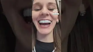Getting Diamond Grillz After Losing My Teeth 🦷💛 
