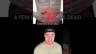 WORST WAYS PEOPLE HAVE DIED!! 