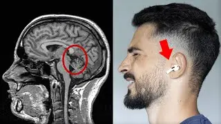 Tes AirPods te crament le cerveau
