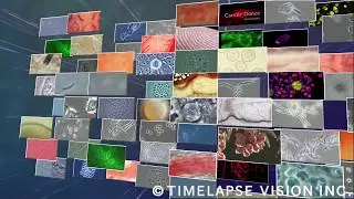 TLV showreel 2017 #03 Immune cells and microbes RUSH
