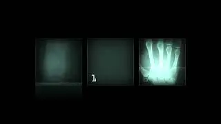 [4K] X-Ray Scanner Animation on Body Part 💀