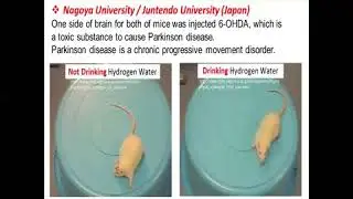 2 Hydrogen Water Helps Parkinson's Disease Clinical Studies