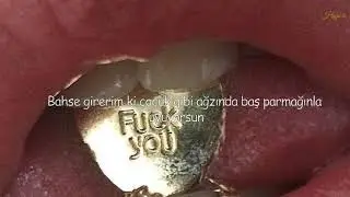 Archive - F*ck U (Türkçe Çeviri)
