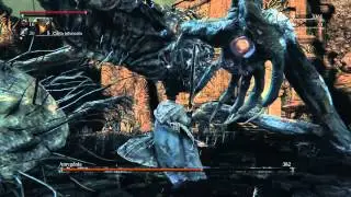 Bloodborne - Amygdala