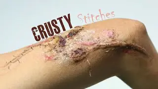 Scabby, Flaky, Crusted, Stitches Prosthetic Makeup Application