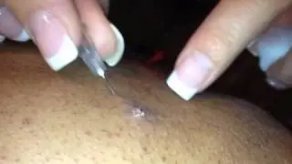 Super Crazy Needle Handler