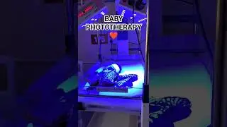 BABY PHOTOTHERAPY 😲☺️ #viral #ytshorts #shorts