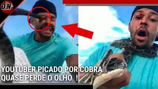 Youtuber picado por cobra Píton, quase perde o olho !