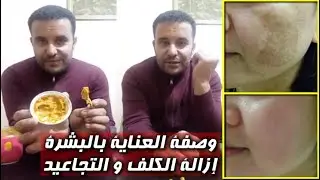 وصفة سحرية في إزالة الكلف و التجاعيد ولبريق الوجه مجانا مع محمد زين الدين