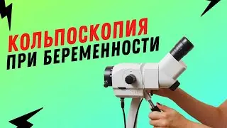 Кольпоскопия при беременности 