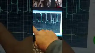 Проверка системы зажигания двигателя G6BA