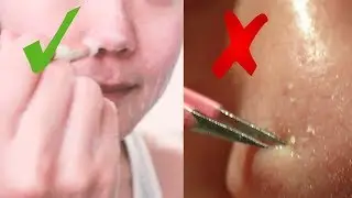 COMO ELIMINAR PUNTOS DE LA NARIZ ¡BELLEZA COREANA!