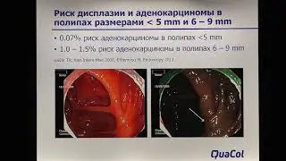 10 Кашин СВ Удаление эпителиальных новообразований от «холодной» полипэктомии до расширенной резекци