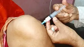 Joint Injection Push.Triamcinolone inj হাঁটুর জয়েন্টে কিভাবে ইনজেকশন দিবেন? 24 Ep 112 Anikhealthtips
