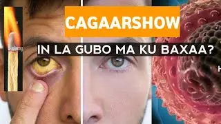 IN LA IS GUBO CAGAARSHOWGU MA KU DAAWOOBAA? @xogocaafimaad