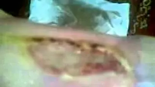 pé no meio do milagre