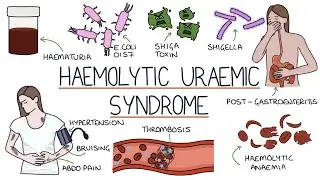 Haemolytic Uraemic Syndrome