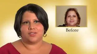 Hair Loss Solutions; ReAllusions Client, Maria