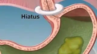 How Does My Stomach Work?