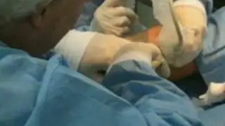 Varicose Veins (Part 1) Signs Symptoms Diagnosis Treatment