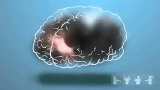 BRAINSTORM! SMH Assist Graphic, 2014