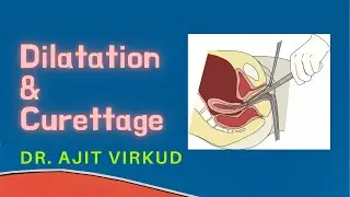 D & C procedure