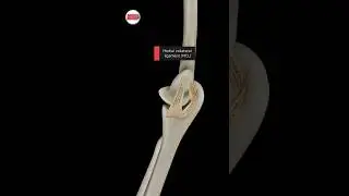 Medial Collateral Ligament (MCL) 