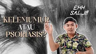 Beauty Talk Episode 3 : EH SALJI! KELEMUMUR ATAU PSORIASIS?
