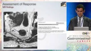 Organ preservation in rectal cancer: How and for whom?