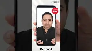 ‼️ Dile adiós al Vitíligo definitivamente con #Dermaoil ‼️