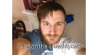 4 Months Hair Growth Time Lapse
