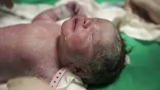 O nascimento da Laura - Parto