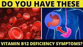 Top Vitamin B12 Deficiency Symptoms That You Should Know | Vitamin B12