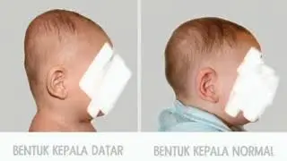 Azruly Baby Pillow Opsimom Bantal Spesialis Anti Peyang || Cegah Kepala Bayi Peyang