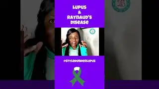Lupus and Raynaud's Disease #lupuswarrior
