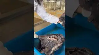 Root of lungs