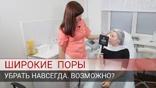 Широкие поры на лице и коже.  Что делать? Как сузить? Почему поры широкие?