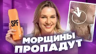 СТРАШНЫЕ последствия ЗАГАРА И ОЖОГОВ! / Как ПРАВИЛЬНО защищаться от солнца и зачем это нужно?