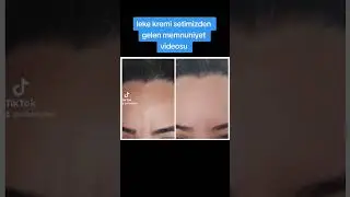 leke kremi setimizden gelen memnuniyet videosu