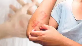 Темираткини уй шароитида даволаш усуллари