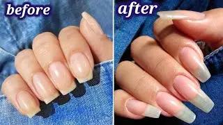 How to grow nails in 2 days || How to grow nails fast overnight  || How to grow nails fast  ||
